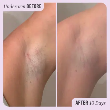 FIRST AID BEAUTY Ingrown Hair Treatment Pads - 28 Pads