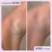 FIRST AID BEAUTY Ingrown Hair Treatment Pads - 28 Pads