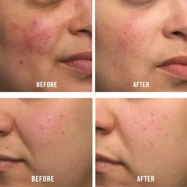 FIRST AID BEAUTY Ultra Repair Cream 56.7g