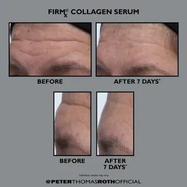 Peter Thomas Roth FirmX Collagen Serum 30ml