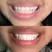 Gem Whitening Pen