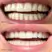 Gem Dissolvable Whitening Strips, 28 sachets