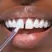 HiSmile Glostik Tooth Gloss