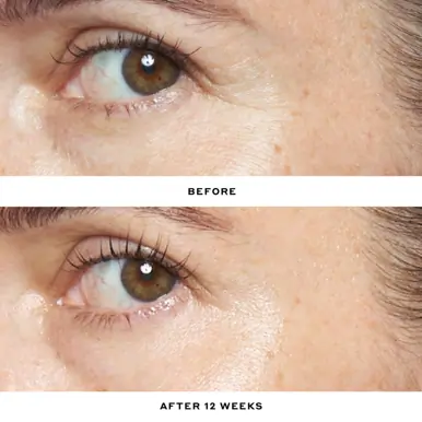 Ole Henriksen Double Rewind Pro-Grade 0.3% Retinol Serum