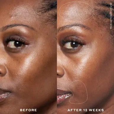 Ole Henriksen Double Rewind Pro-Grade 0.3% Retinol Serum