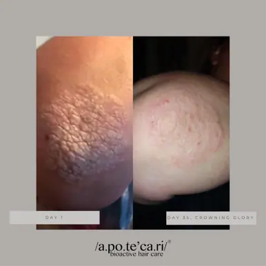 Apotecari Crowning Glory 60 Day Bottle | Perfected Scalp Health & Balanced Hydration