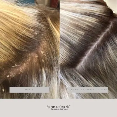 Apotecari Crowning Glory 30 Day Replenish Pack | Perfected Scalp Health & Balanced Hydration