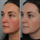 Liberty Belle Rx by Dr Moss GAME CHANGER® Pore Refining & Mattifying Gel With Vitamin C - 30ml