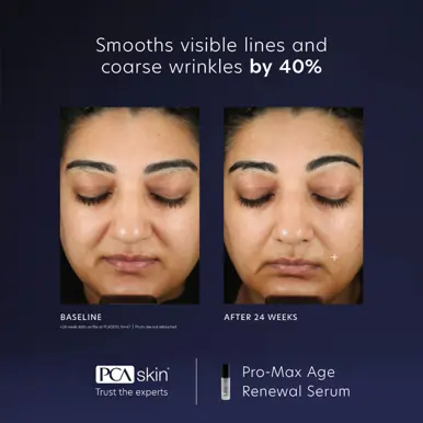 PCA Skin Pro-Max Age Renewal