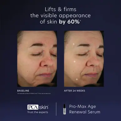 PCA Skin Pro-Max Age Renewal