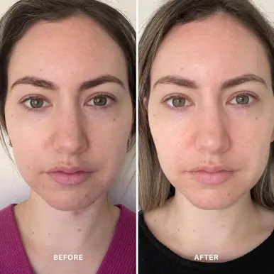 Alpha-H Vitamin B Serum with 5% Niacinamide 25ml