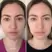 Alpha-H Vitamin B Serum with 5% Niacinamide 25ml