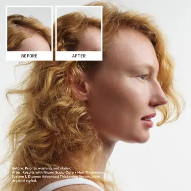 Nioxin Scalp + Hair Thickening System 1 - Hair Thickening System Trial Kit