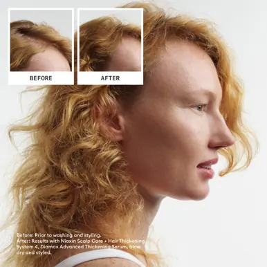 Nioxin Scalp + Hair Thickening System 4 - Hair Thickening System Trial Kit