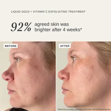 Alpha-H Liquid Gold Exfoliating Treatment with Vitamin C 100ml