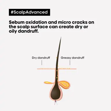 L'Oréal Professionnel Serie Expert Scalp Advanced Anti-Dandruff Shampoo 300ml
