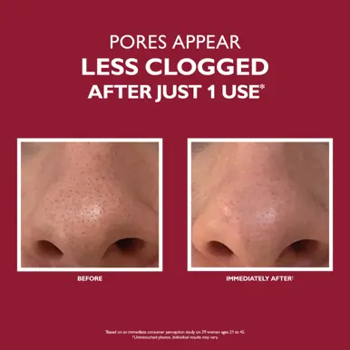 Peter Thomas Roth Even Smoother Microdermabrasion Pore Purifier