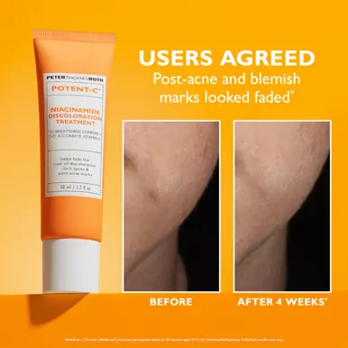 Peter Thomas Roth Potent-C Discoloration Treatment