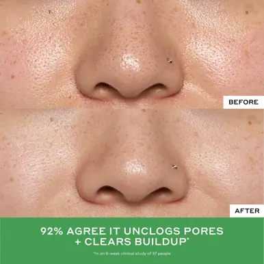 Ole Henriksen Balance + Detox Drops 2% Salicylic Acid Toner 
