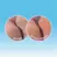 Dermal Therapy Heel Balm