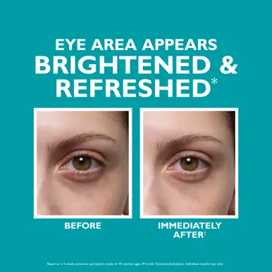 Peter Thomas Roth Peptide Skinjection™ Under-Eye Filler Tinted Cream 15ml