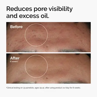The Ordinary Supersize Niacinamide 10% + Zinc 1% - 60ml