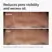 The Ordinary Supersize Niacinamide 10% + Zinc 1% - 60ml