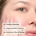 The Ordinary Glucoside Foaming Cleanser - 150ml
