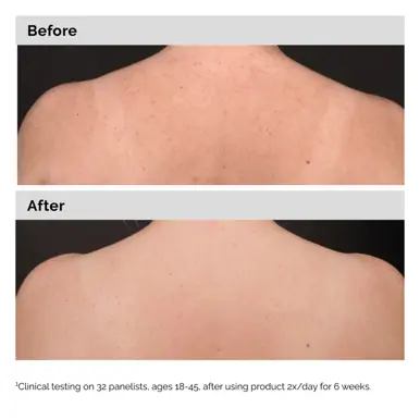 The Ordinary Salicylic Acid 0.5% Body Serum - 240mL
