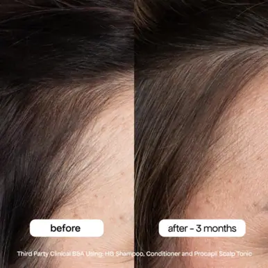 Bondi Boost Procapil Anti-Thinning Tonic