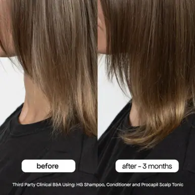 Bondi Boost Procapil Anti-Thinning Tonic