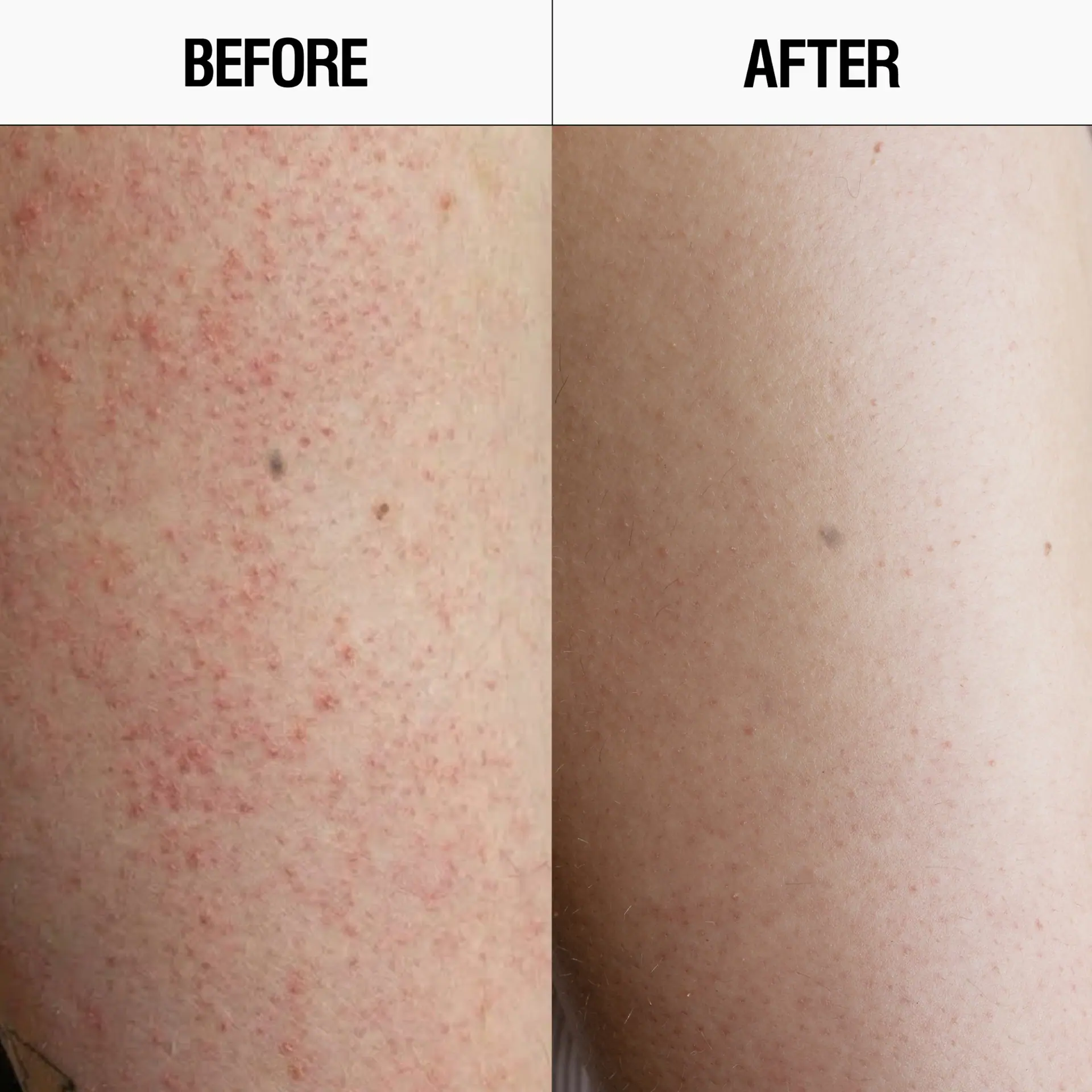 Grown Alchemist Resurfacing Body Cleanser AHA + BHA 300ml