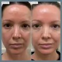 Alpha-H Vitamin B Serum with 0.5% Niacinamide 10ml
